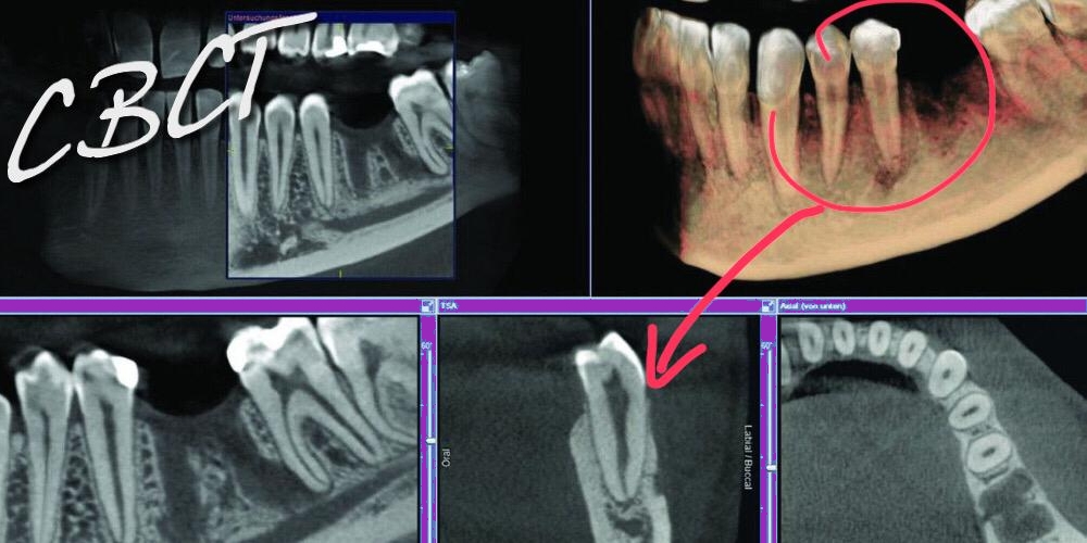 קורס מתקדם בתפעול ופענוח CBCT